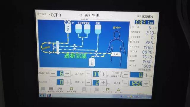 腹膜透析机的优势