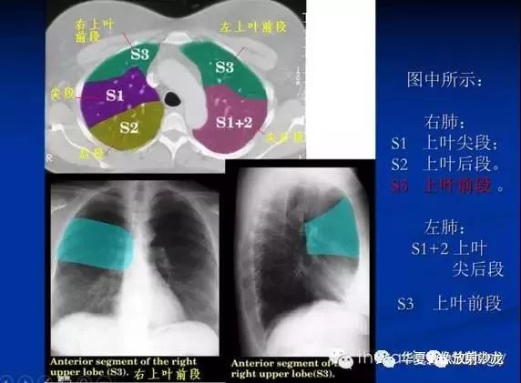 最详尽的图文解说:肺的分段解剖