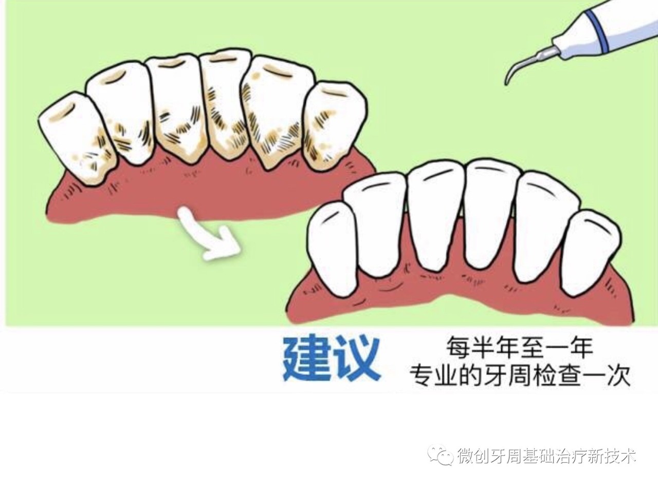 get新技能,告别"假装刷牙,远离牙周病