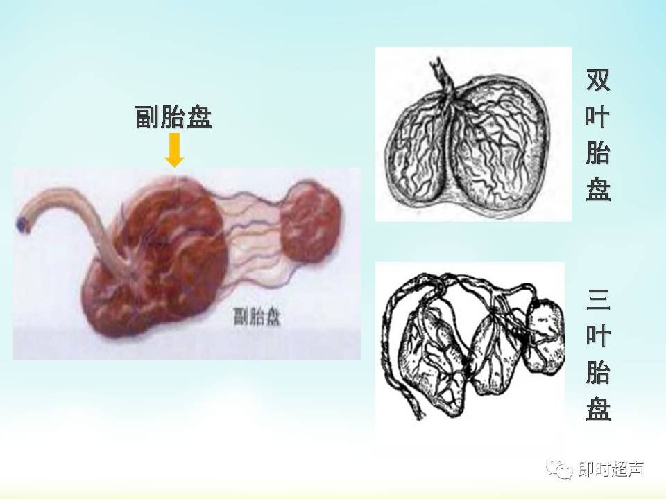 胎盘及脐带异常