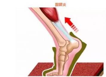 穿高跟鞋鞋跟歪怎么办