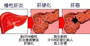 血吸虫让27岁的他患上肝硬化,切除脾脏痛苦了45年,72