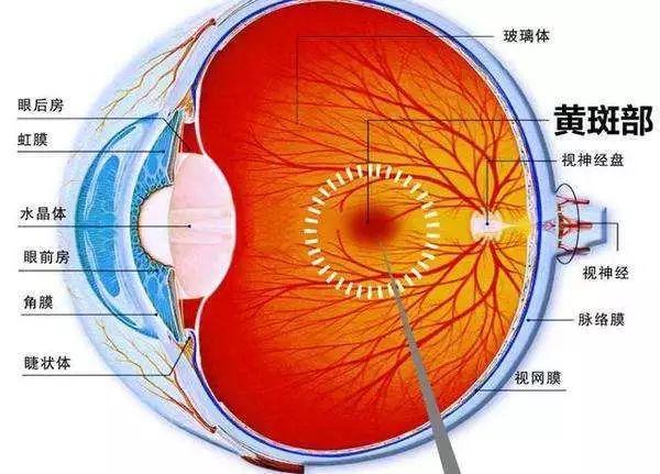 眼底黄斑病变及早治疗别大意!