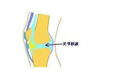 健康 正文  因为髌骨不在正确位置上,也使膝关节不能处于其本身最稳的