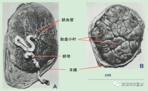 胎膜由绒毛膜和羊膜组成脐带2条脐动脉,1条脐静脉长约30～70cm,平均约