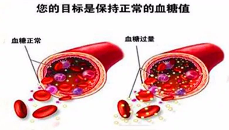 这样降血糖