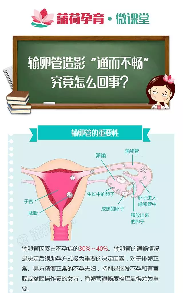 输卵管通而不畅?还可能怀孕吗?