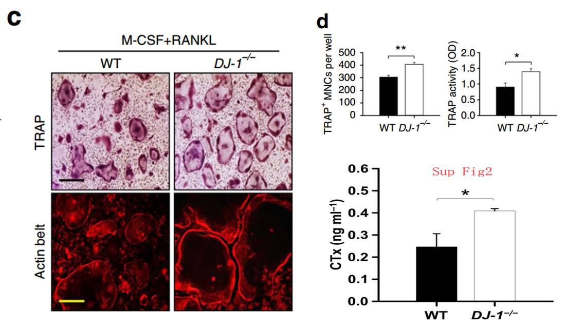 dj1通过调控破骨细胞分化调节骨稳态文献精读