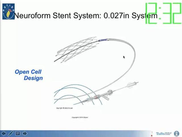 neuroform atlas支架治疗颅内动脉瘤