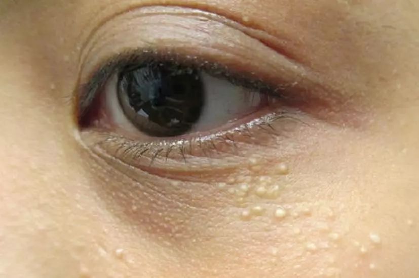 一旦眼睛出现这8种症状,可能是大病征兆!