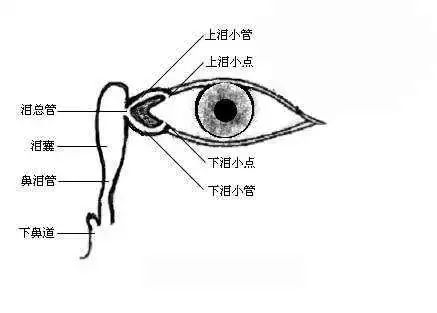 主要包括泪道炎症,外伤,异物,肿瘤,寄生虫和先天异常等,尤以慢性泪囊