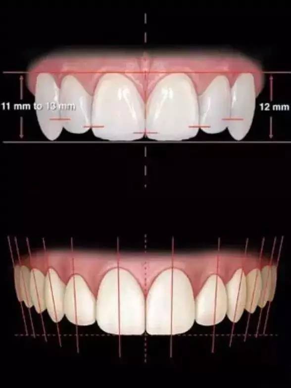 牙齿宽度 前牙的黄金分割比例正面观 侧切牙约为中切牙的60% 尖牙约