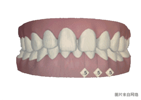 一张图看懂牙齿矫正全过程
