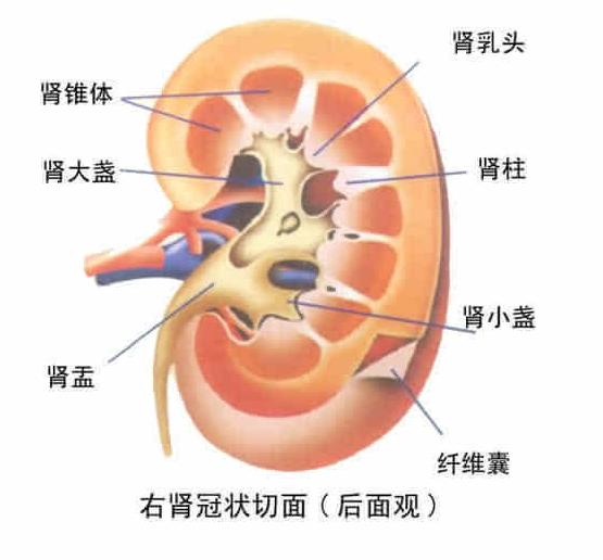 尿道刺痛当心肾结石 常见的肾结石症状及并发症