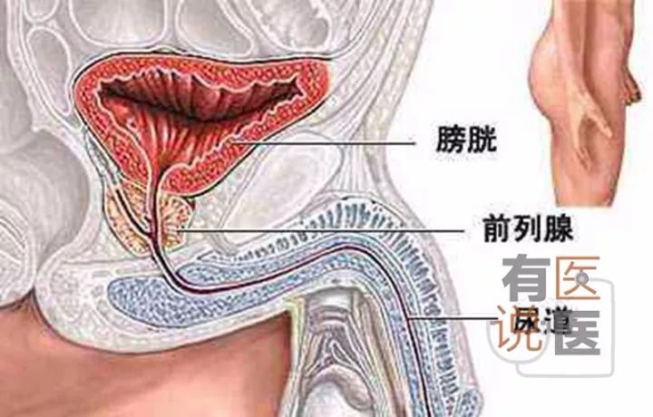 男子把锁头从尿道塞进了膀胱,这是什么操作?