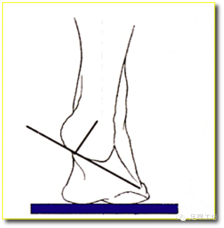 图解足踝生物力学—知道你是如何走路的吗?