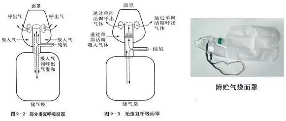 潮式呼吸发生的原理是什么_什么是腹式呼吸图解