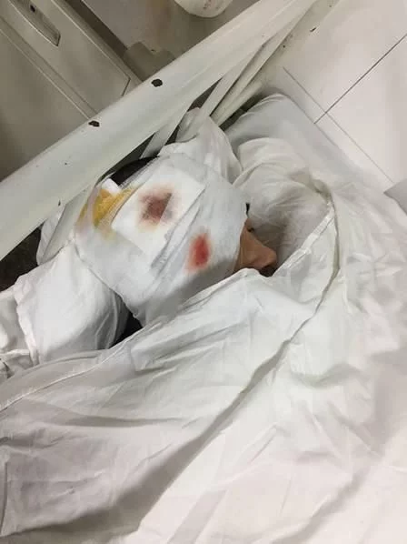 樊昊仑脸上包了纱布,血迹清晰可见,在病床上昏迷过去.