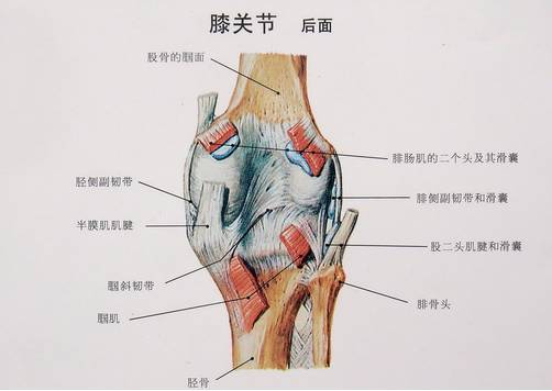 什么是半月板撕裂