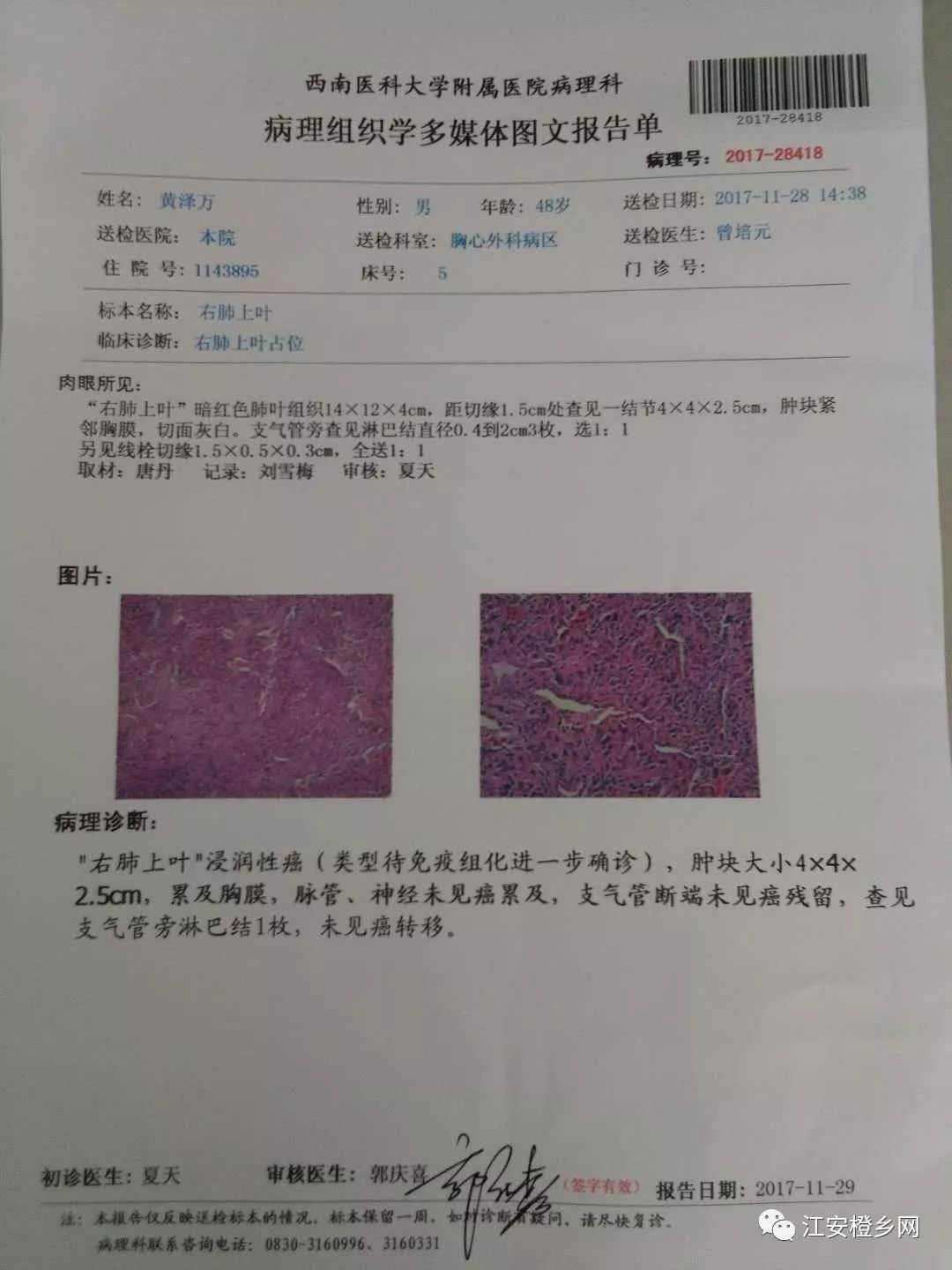 江安高三学生求助父亲不幸运罹患癌症求各位好心人救救我这个家