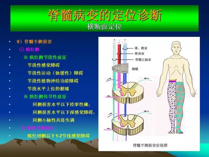 每日锦囊脊髓病变的定位诊断