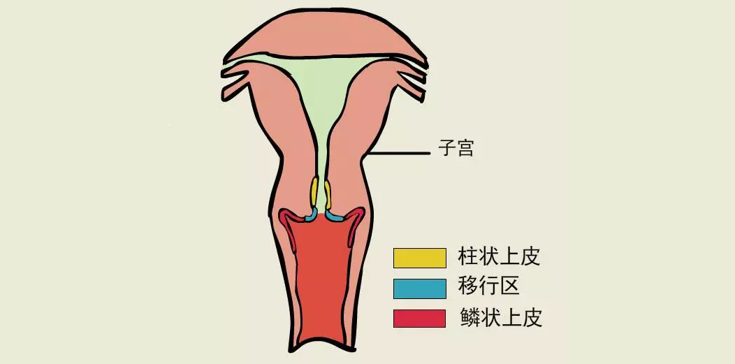 "宫颈糜烂"的忏悔书:惊着各位小主了,请收下我的膝盖