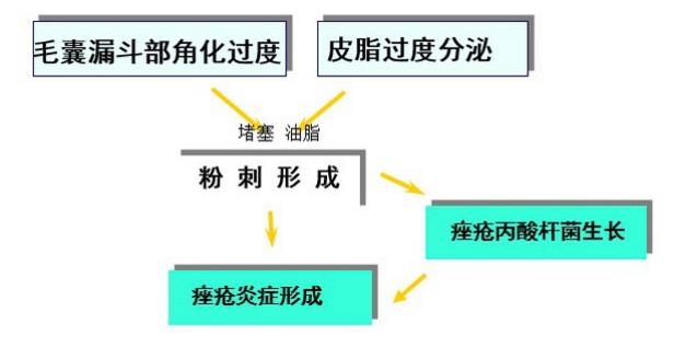 脸上长痘什么原因,痘痘跟哪些因素有关