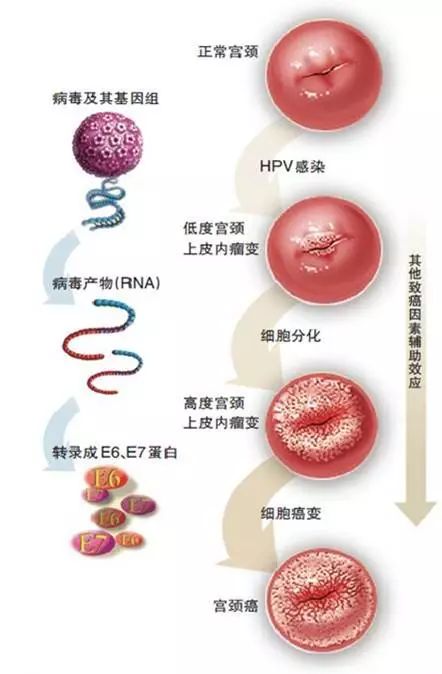 宫颈糜烂不是病,但你的宫颈就真的没病吗?