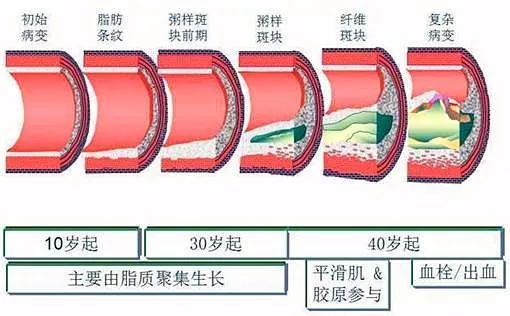 最重要的是:血管外周的人体器官就会每分每秒受到不正常血压的磨损