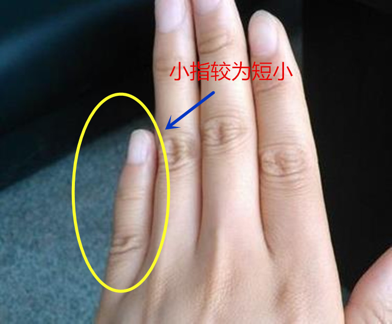 小指的长度超过无名指第三指节横纹,到达无名指第三节的位置,代表