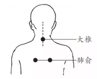 内附咳嗽,发烧感冒的刮痧疗法