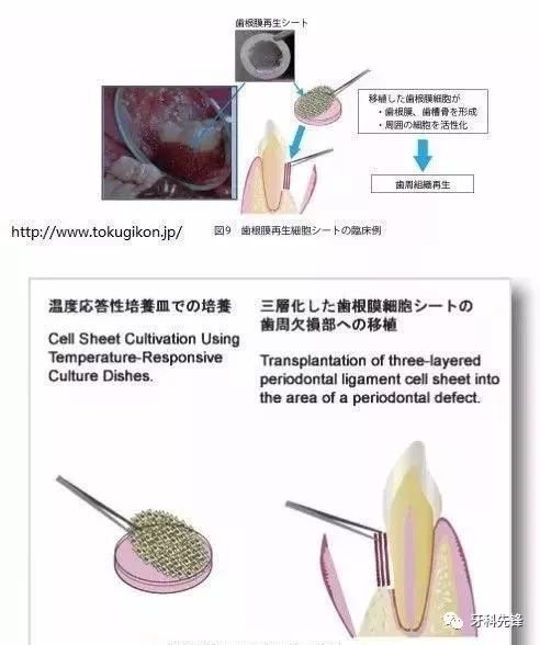 日本这些牙齿再生研究最新资讯,您知道吗?