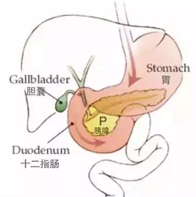 99%的人搞不清!慢性胆囊炎和慢性胃炎的区别