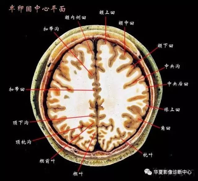 影像基础半卵圆中心与放射冠有什么区别