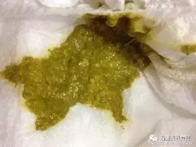 排出体外,在暴露空气中后氧化成绿色了,这种情况多见于奶粉喂养的宝宝