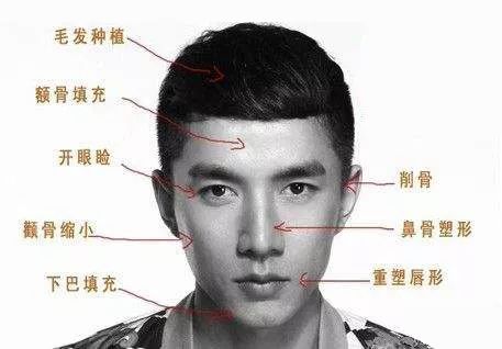 男人整形也走俏,驻颜塑体惊艳到爆