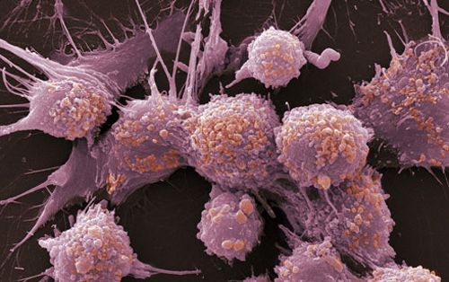 就是这么一群细胞及其容易变异为癌细胞甚至发生其他病变,最最关键的