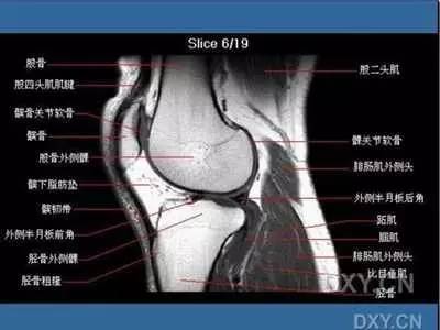 高清图解:磁共振下的膝关节