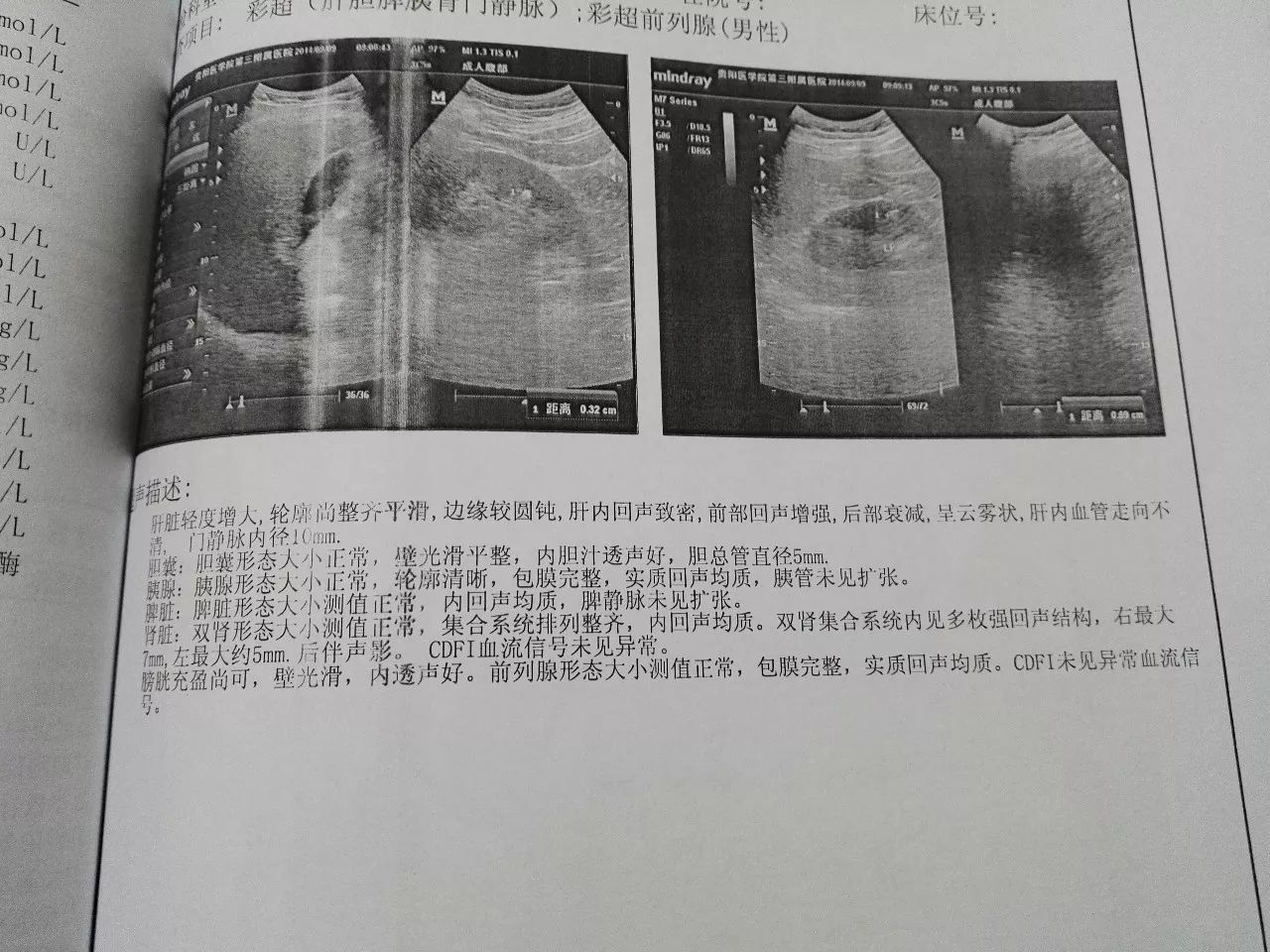 给有痛风,双肾多发性结石朋友的练功参考|学员心得