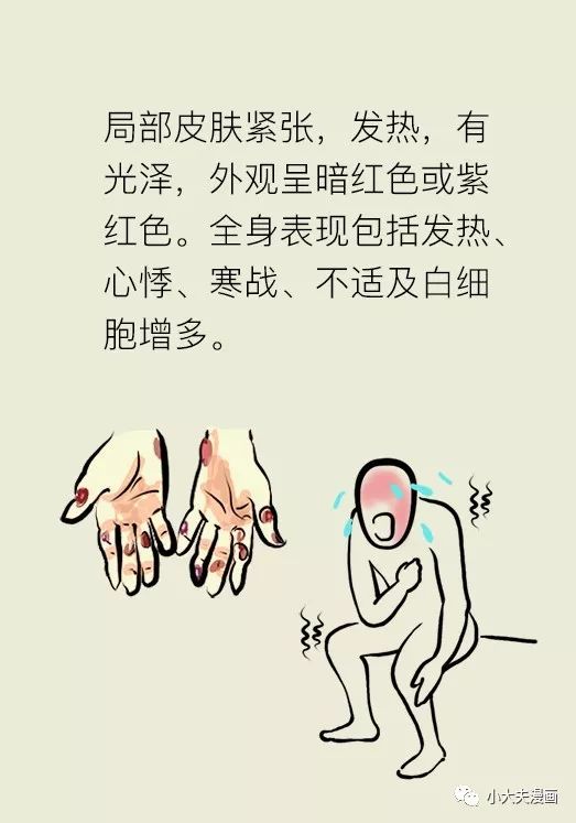 得了痛风怎么办30张漫画告诉你