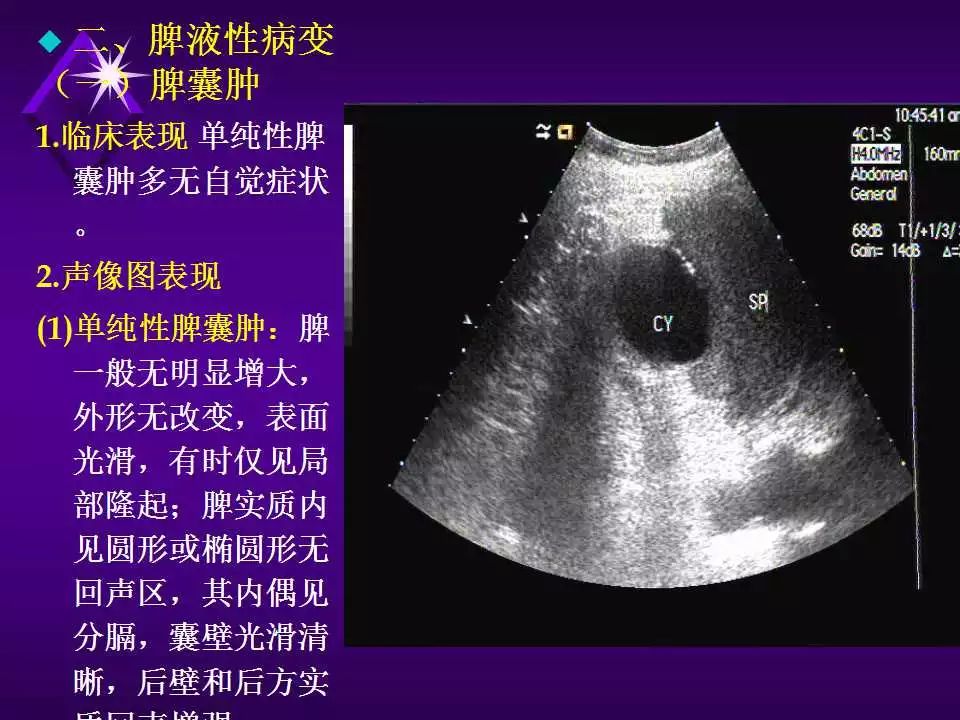 脾脏超声诊断