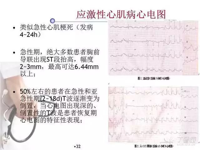 精彩幻灯|心肌炎与心肌病的心电图改变