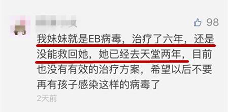 孩子出现这些症状 家长赶紧带孩子就医 eb病毒感染的症状与感冒很像