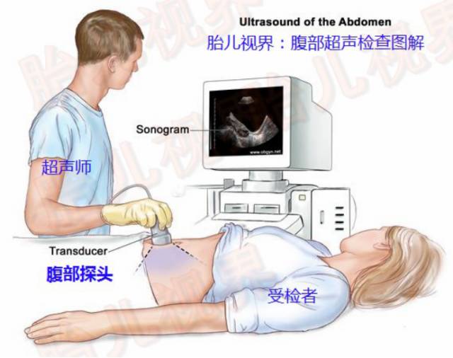 图二,腹部超声检查过程示意图(图片来自教材)