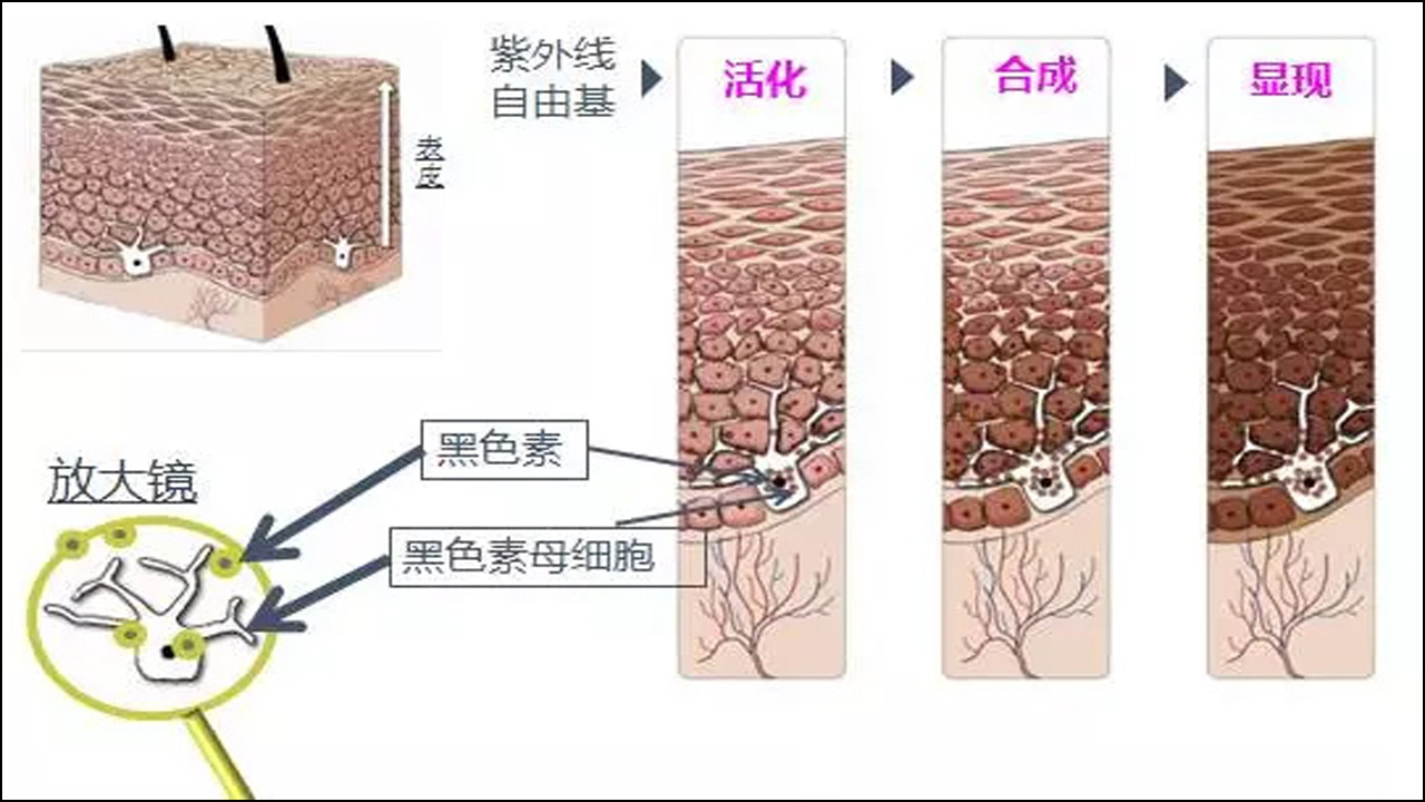 寻找boss 皮肤色斑元凶-黑色素