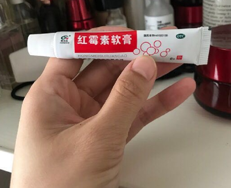 时尚 正文  方法二:准备材料:阿司匹林,红霉素软膏.