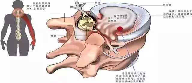 人口手足_人口手足(3)