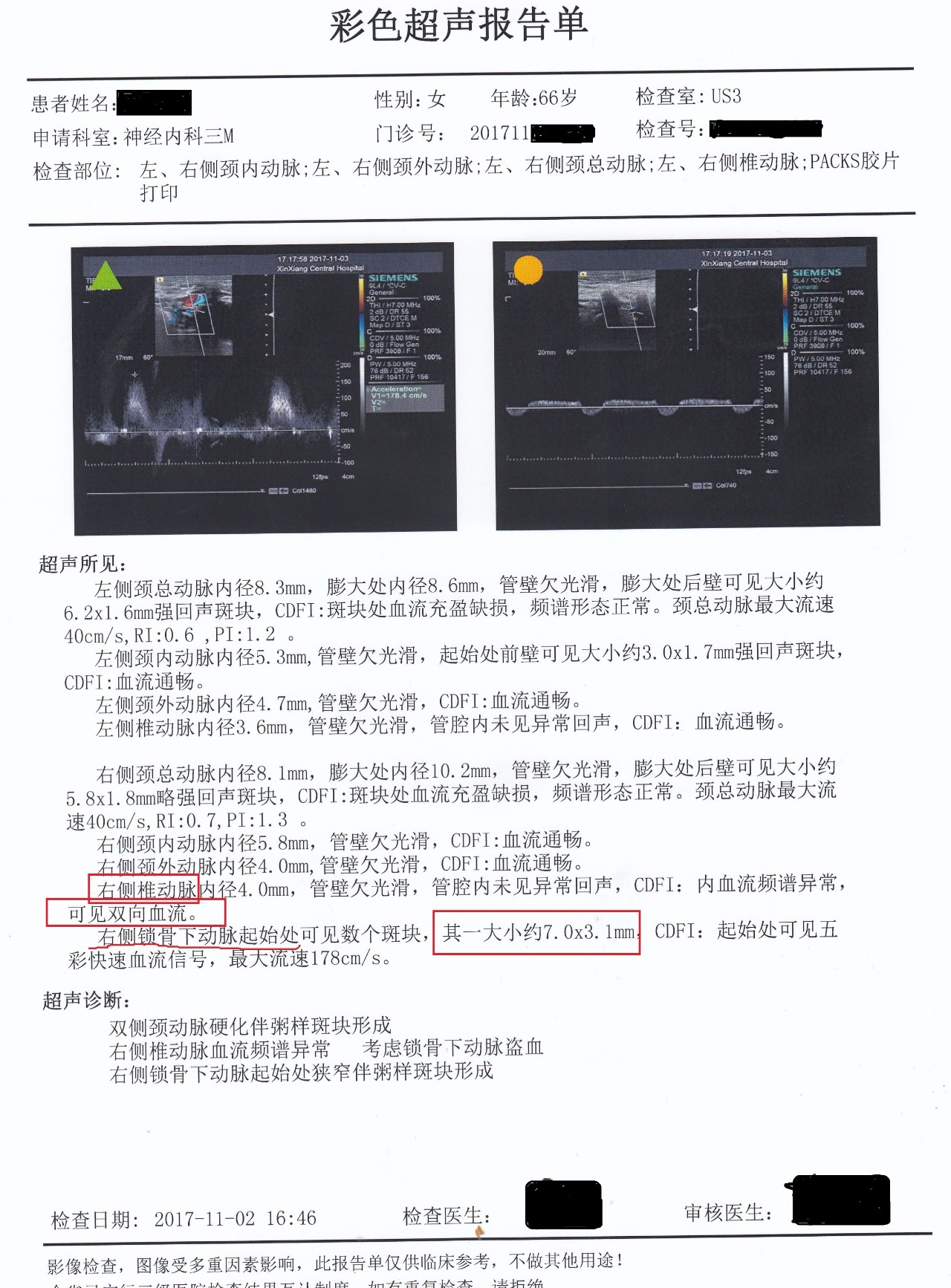 参考文献 【1】吴滢,钟萍,锁骨下动脉盗血综合征一例并文献复习,中华