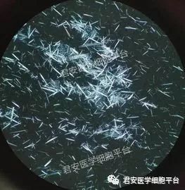 璀璨如星辰伤人于无形之尿酸结晶