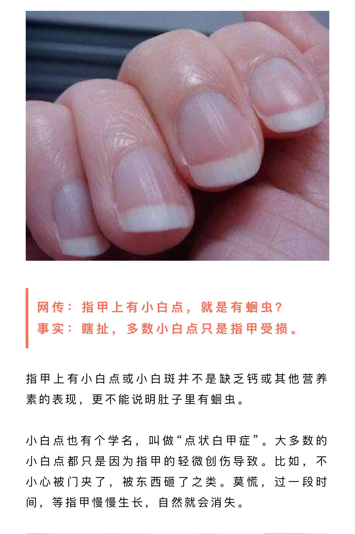 被骗了,指甲上的"小太阳"不是越多越好!假的!